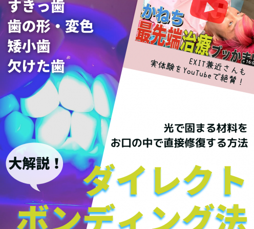 症例紹介「インビザラインGOとダイレクト
