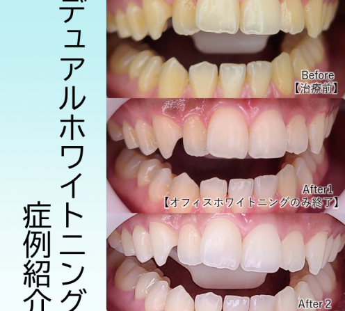 お友達と２人合わせて10000円もらっち