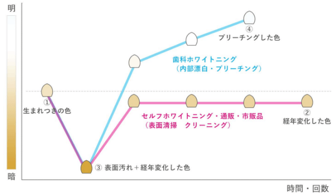 歯科ホワイトニングとセルフホワイトニング・市販品の違い