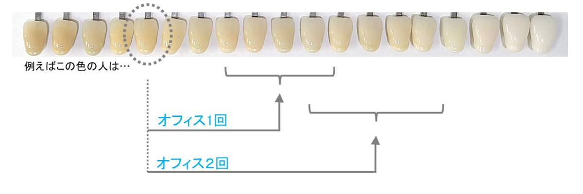 オフィスホワイトニング