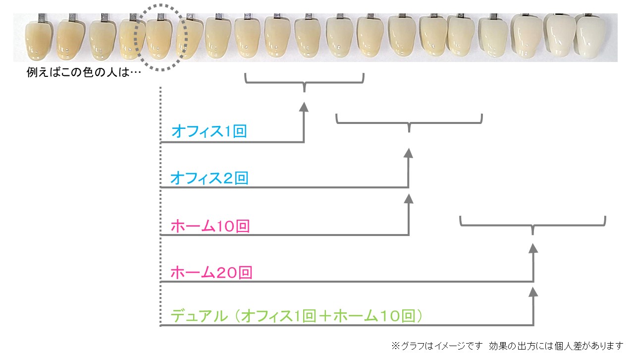 私にはどの方法?